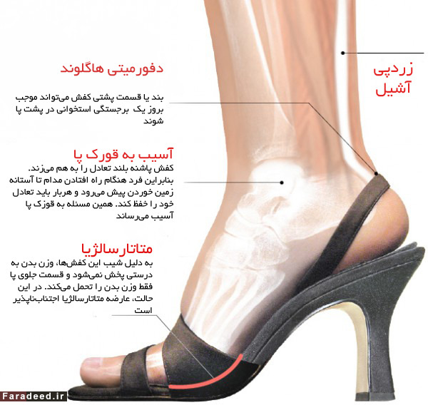 کفش پاشنه بلند؛ به چه قیمتی؟ کفش پاشنه بلند؛ به چه قیمتی؟