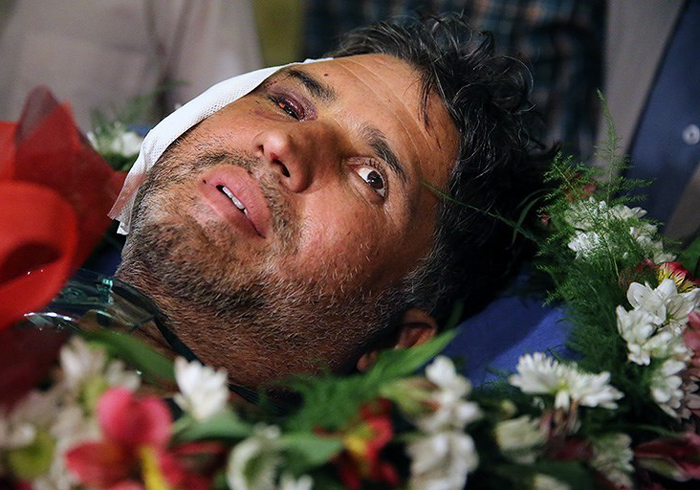 (تصاویر) بازگشت خبرنگار مجروح از سوریه (تصاویر) بازگشت خبرنگار مجروح از سوریه