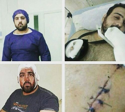ضرب و شتم ملی پوش جودو توسط ماموران شهرداری ضرب و شتم ملی پوش جودو توسط ماموران شهرداری
