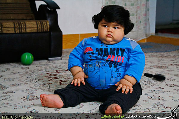 (تصاویر) کودک یک ساله بجنوردی با ۴۲ کیلو وزن (تصاویر) کودک یک ساله بجنوردی با ۴۲ کیلو وزن