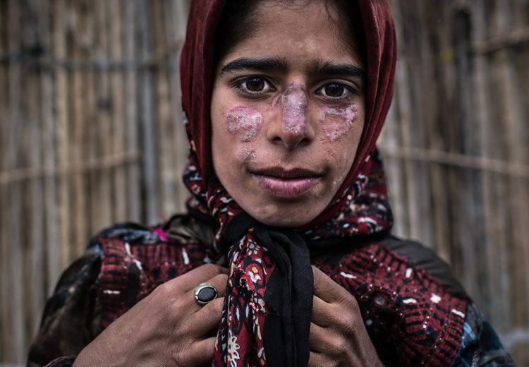تصویر تصویر