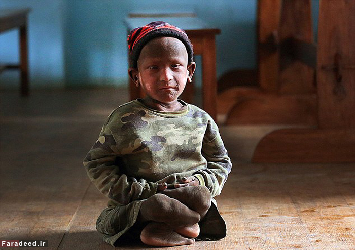 (تصاویر) پسرک نپالی در حال سنگ شدن (تصاویر) پسرک نپالی در حال سنگ شدن