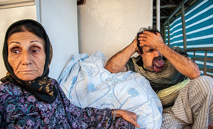 (تصاویر) بیماری دردناک اسماعیل (تصاویر) بیماری دردناک اسماعیل