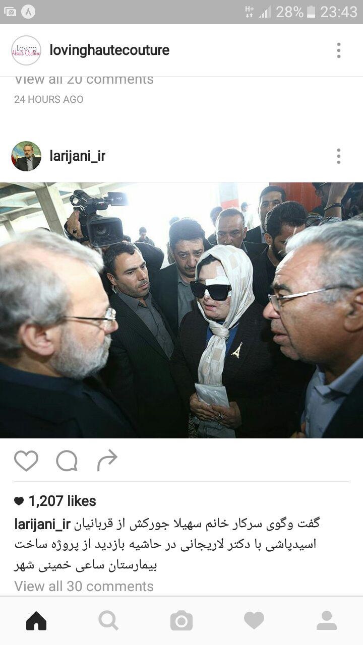 (تصویر) گفتگوی یک قربانی اسیدپاشی با لاریجانی