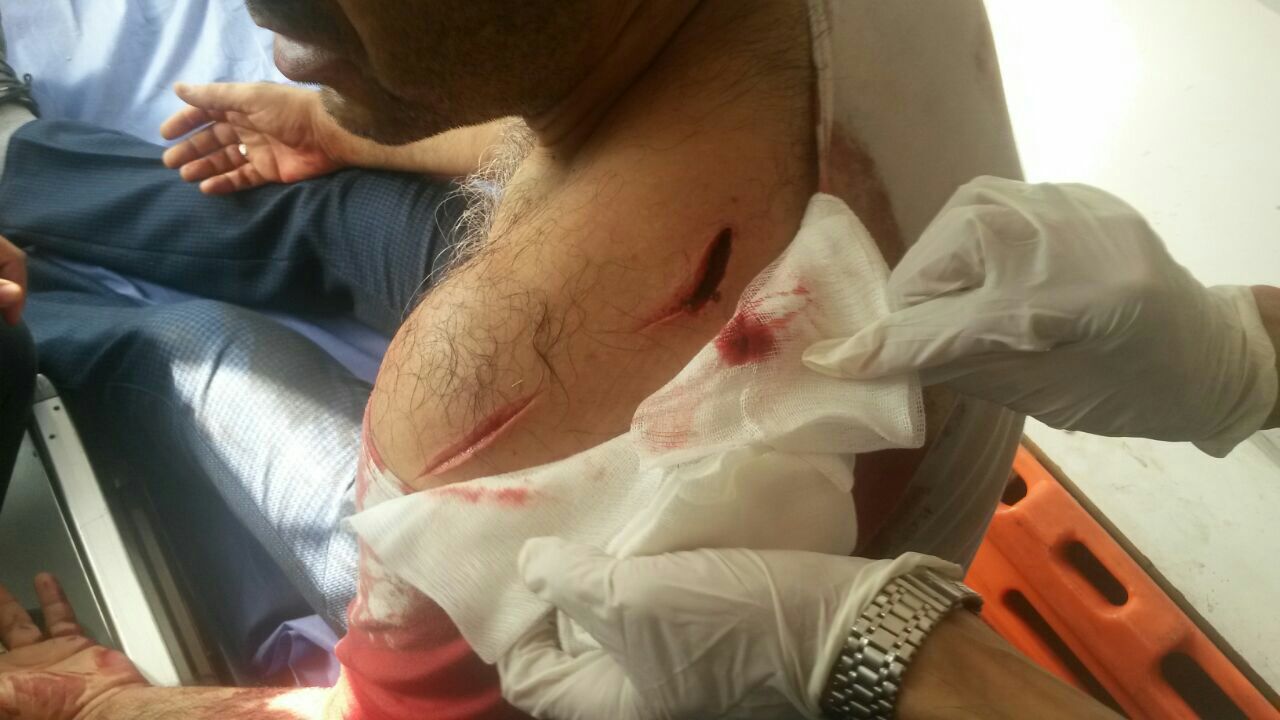 حمله با چاقو به مسافران در ترمینال جنوب حمله با چاقو به مسافران در ترمینال جنوب