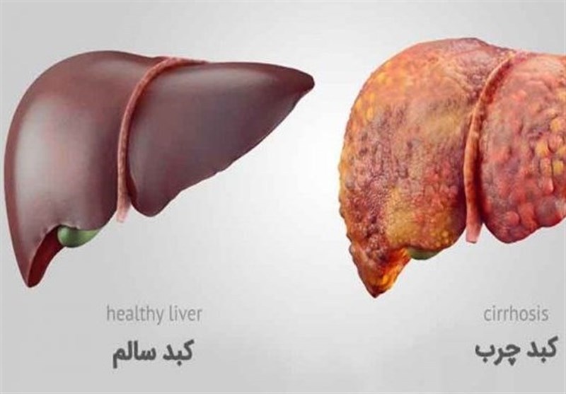 با داشتن این علائم به 