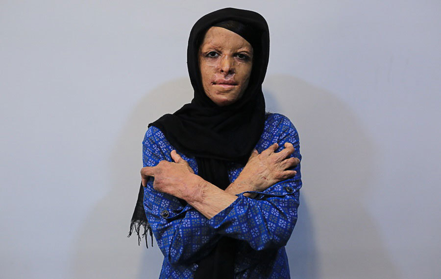 ۳۶۰ جراحیِ بی‌نتیجه روی دختران شین‌آبادی
