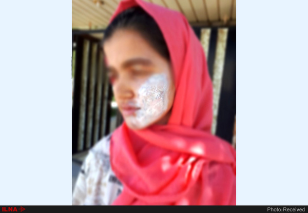 نامادری‌ام صورت و دستم را با اتوی داغ سوزاند!