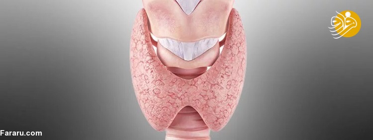 پر کاری تیروئید پر کاری تیروئید