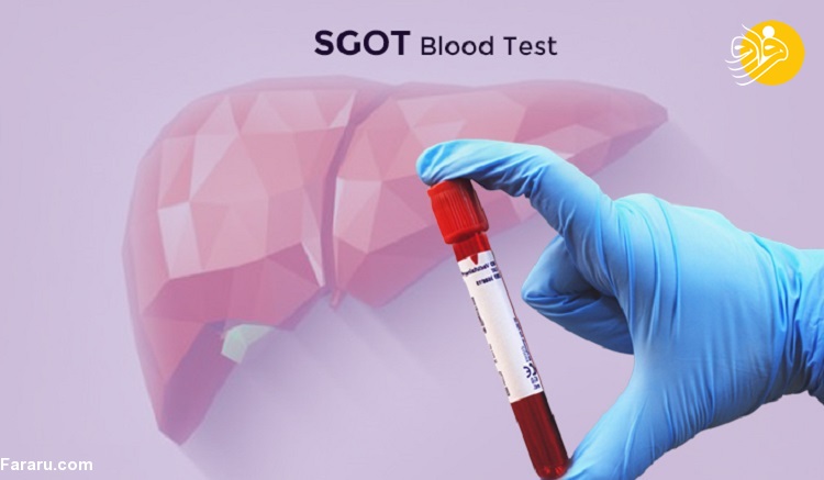 آزمایشSGOT یا AST چیست؟ آزمایشSGOT یا AST چیست؟