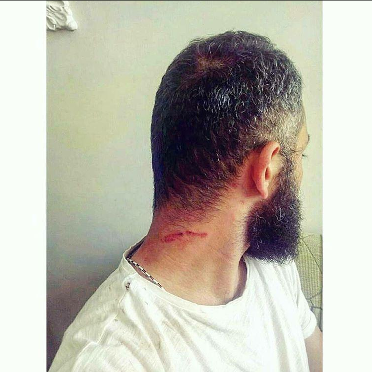 روایت‌های تکان‌دهنده از آزار جنسی دوچرخه‌سواران در جاده‌ها!