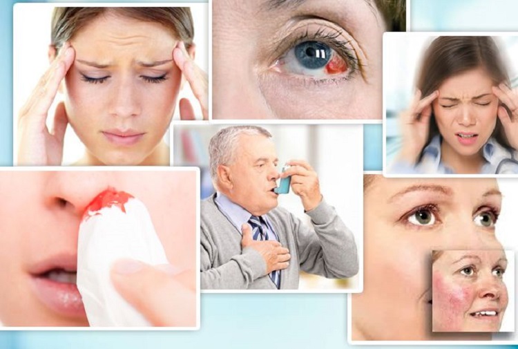 علائم فشار خون بالا فشار خون بالا؛ زمینه ها، علل و درمانهای این بیماری