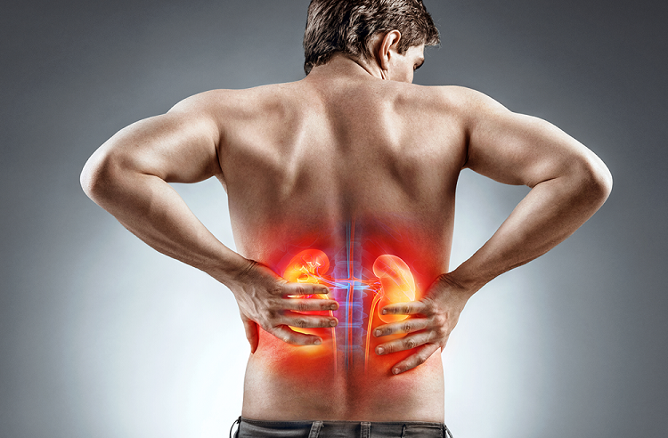 علائم سنگ کلیه سنگ کلیه؛ علل، نشانهها و راههای درمان و پیشگیری از آن