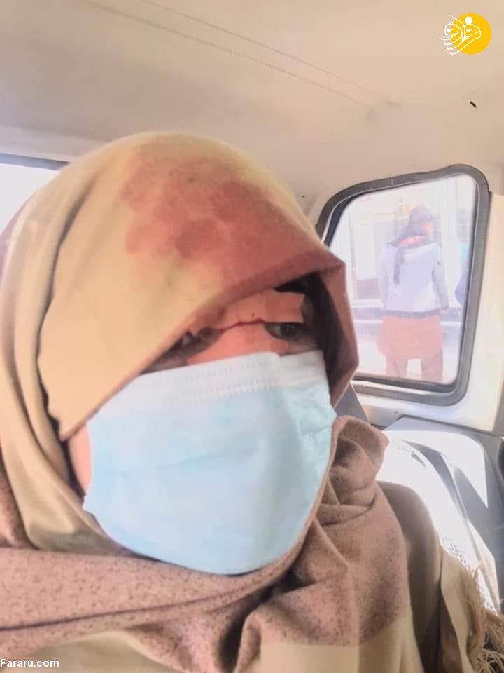 (ویدئو) طنین شعار «نان، کار، آزادی» در تجمع زنان معترض کابل (ویدئو) طنین شعار «نان، کار، آزادی» در تجمع زنان معترض کابل