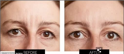 اختراعی که طرفداران جوان ماندن و زیبایی را دیوانه می‌کند/ ماسکی برای برطرف سازی چین و چروک در چند دقیقه