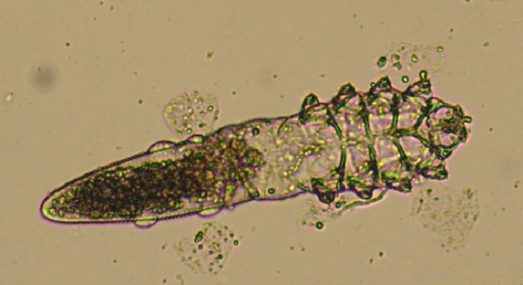  Demodex folliculorum.