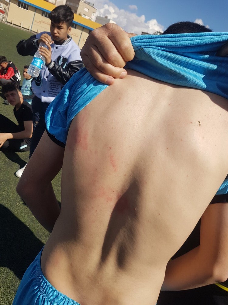 (عکس) چاقو و قمه در مسابقات فوتبال نونهالان