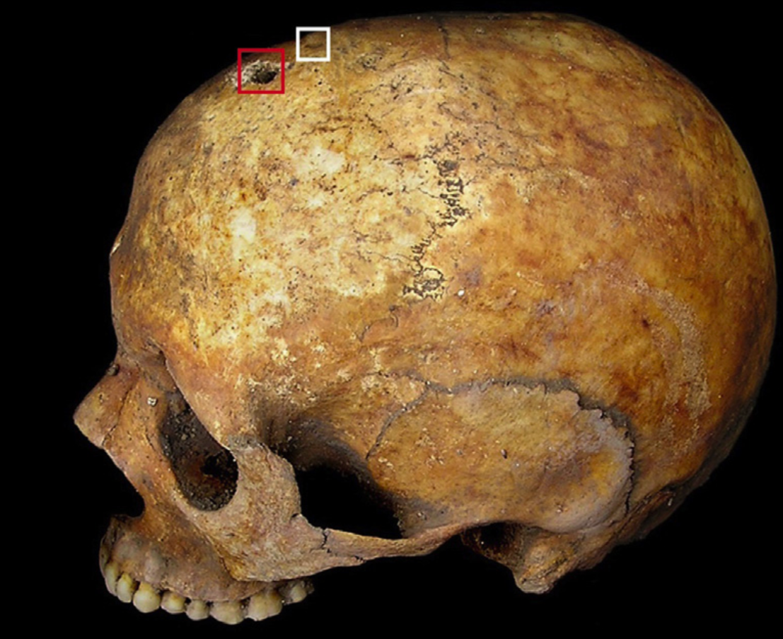 راز جنینی که در گور به دنیا آمده بود!