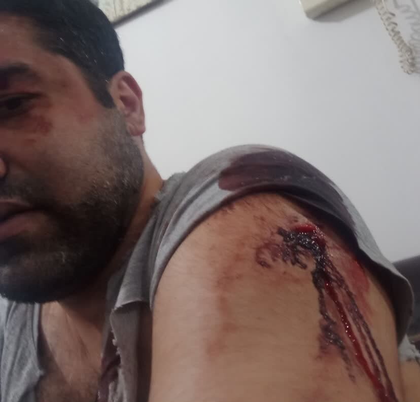 (عکس) مجروح‌شدن یک استاد دانشگاه توسط مزاحمین بانوان