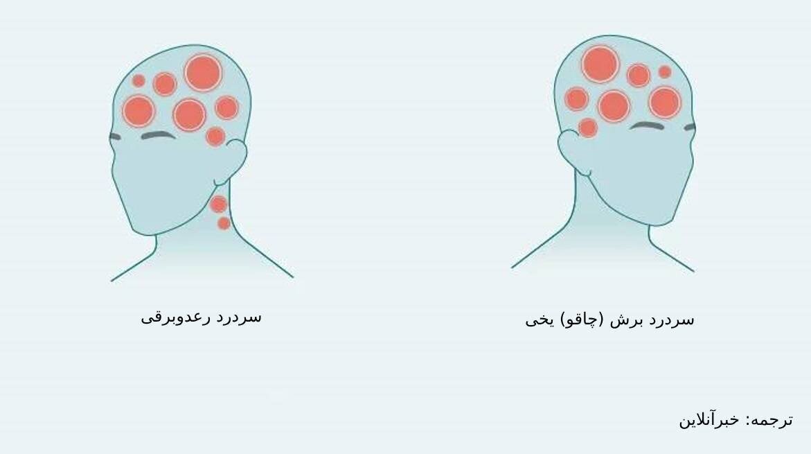 از کافئین تا فشار خون بالا؛ شایع‌ترین عوامل ایجاد سردرد