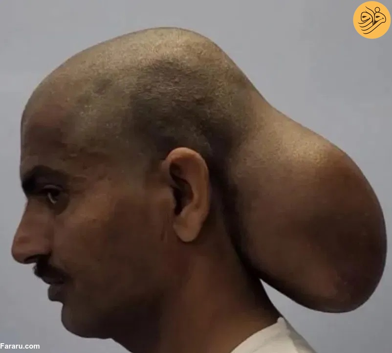 (عکس)