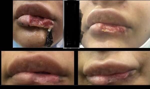 وزارت بهداشت: پزشکان عمومی تیغ زیبایی را زمین بگذارند!