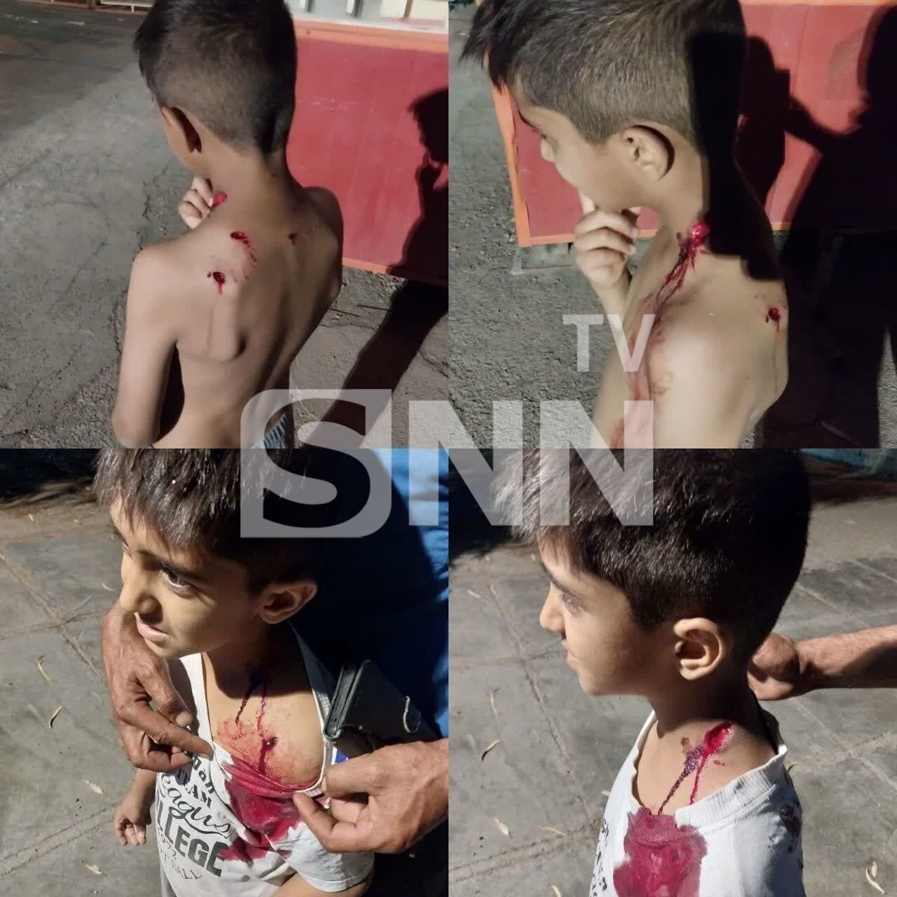 حمله سگ‌های ولگرد به یک دانش‌آموز