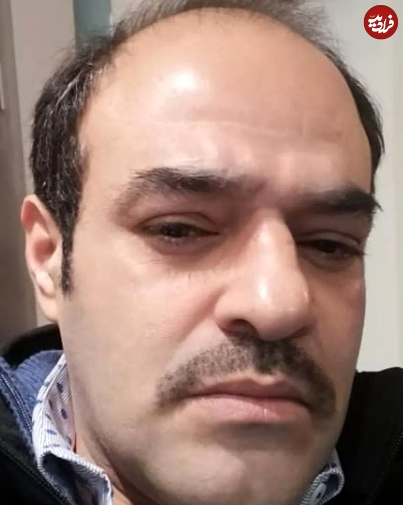 (تصویر) تغییر چهره «کاووس» سریال پایتخت بعد ۵ سال در ۳۳ سالگی در کانادا